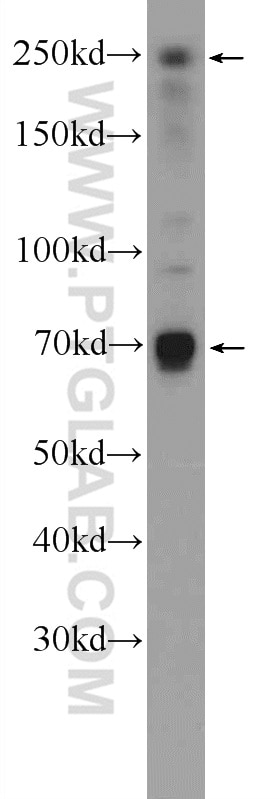 Western Blot (WB) analysis of HEK-293 cells using EIF4G3 Polyclonal antibody (11281-1-AP)