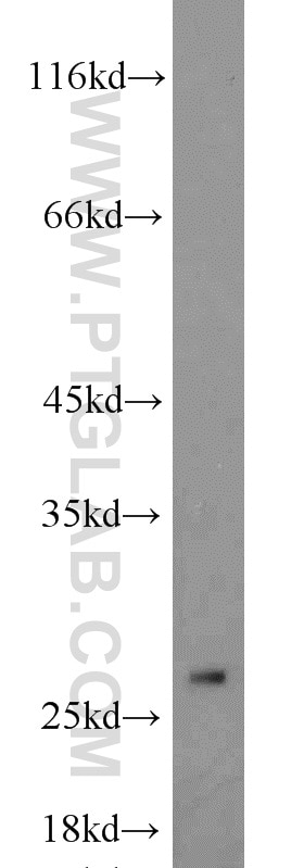 Western Blot (WB) analysis of HeLa cells using EIF4H Polyclonal antibody (11012-1-AP)