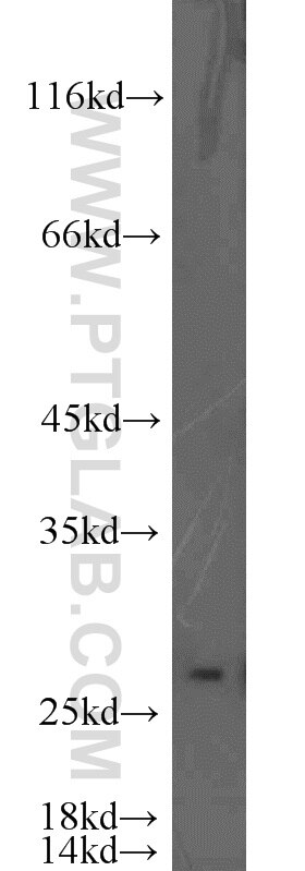 Western Blot (WB) analysis of PC-3 cells using EIF4H Polyclonal antibody (11012-1-AP)