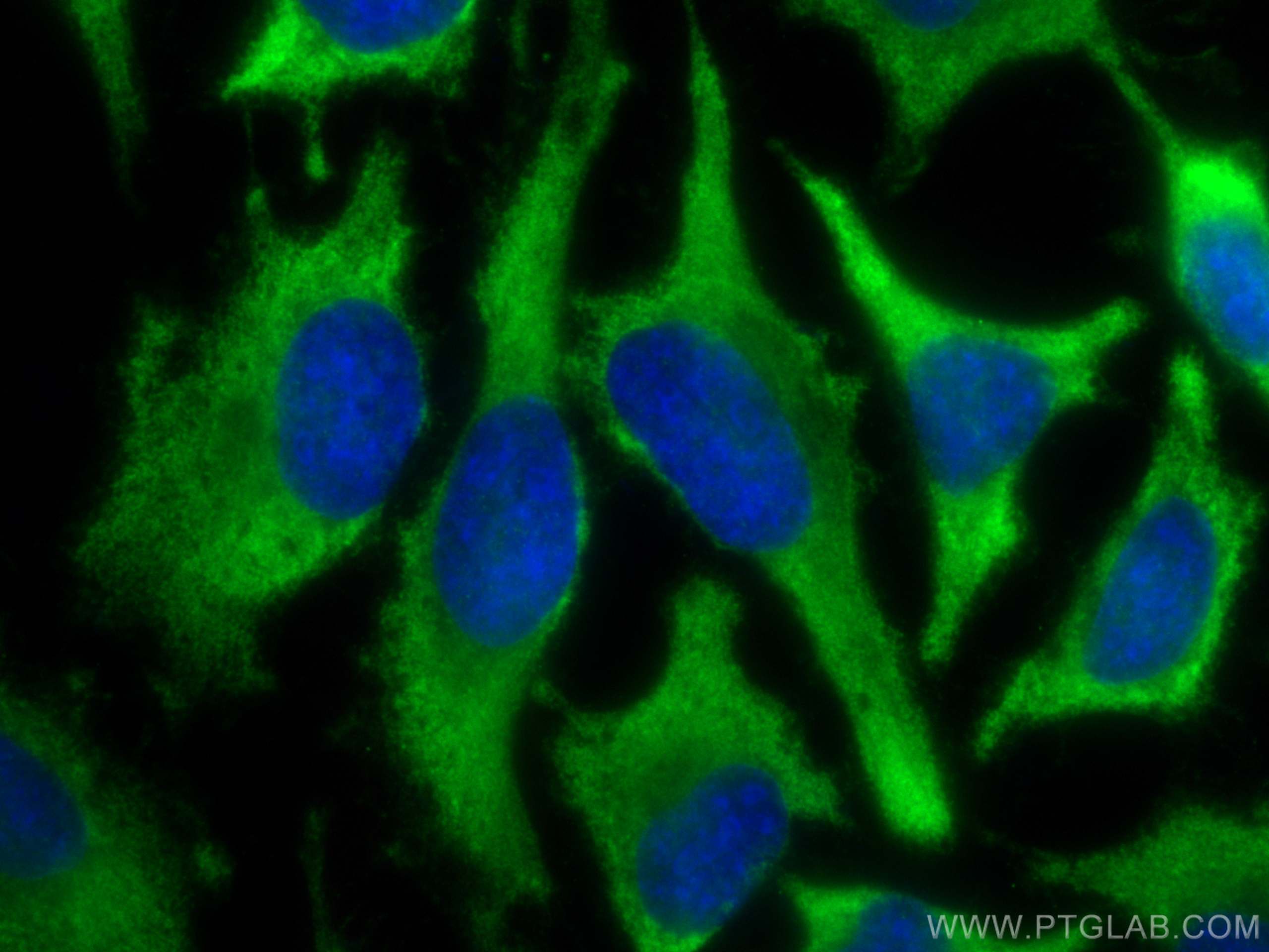 Immunofluorescence (IF) / fluorescent staining of HeLa cells using EIF5 Polyclonal antibody (11155-1-AP)