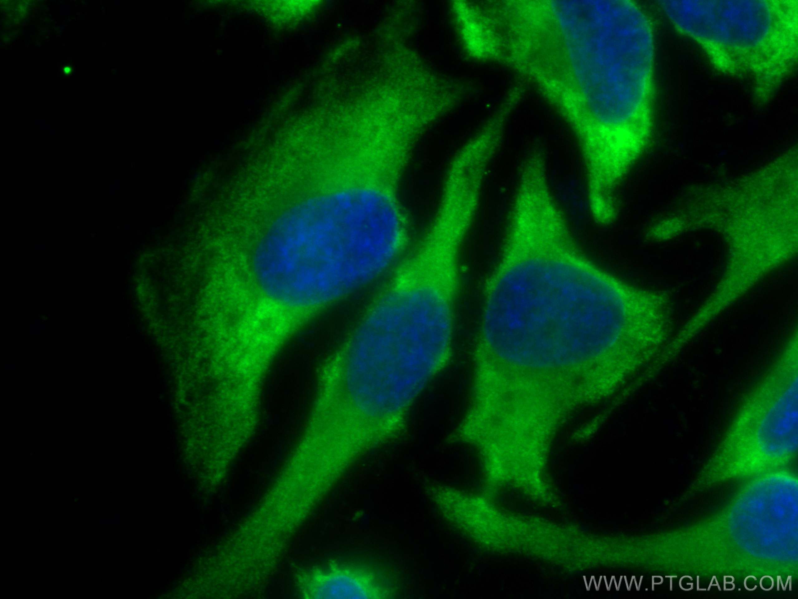 Immunofluorescence (IF) / fluorescent staining of HeLa cells using EIF5 Polyclonal antibody (11155-1-AP)
