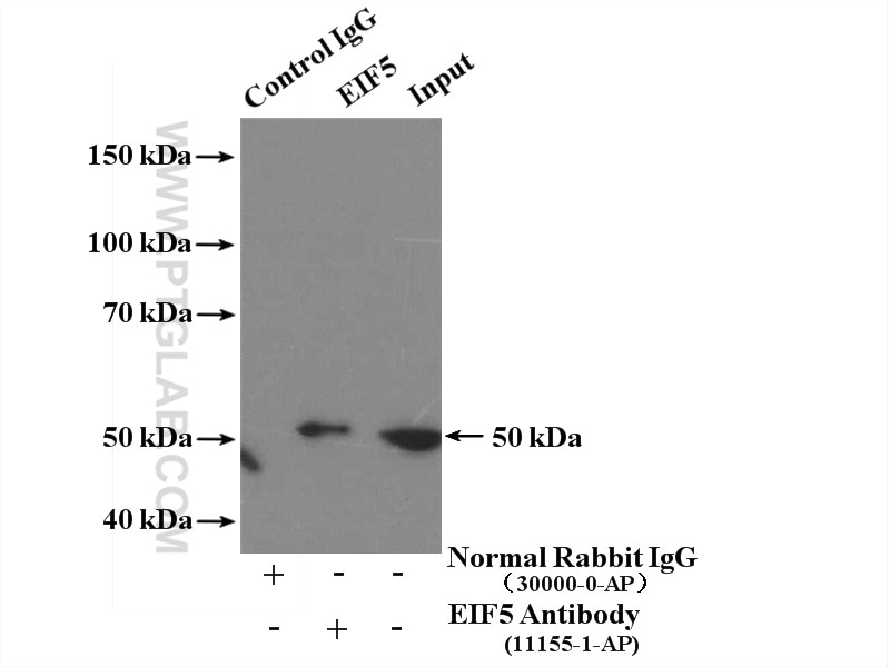 IP experiment of HeLa using 11155-1-AP