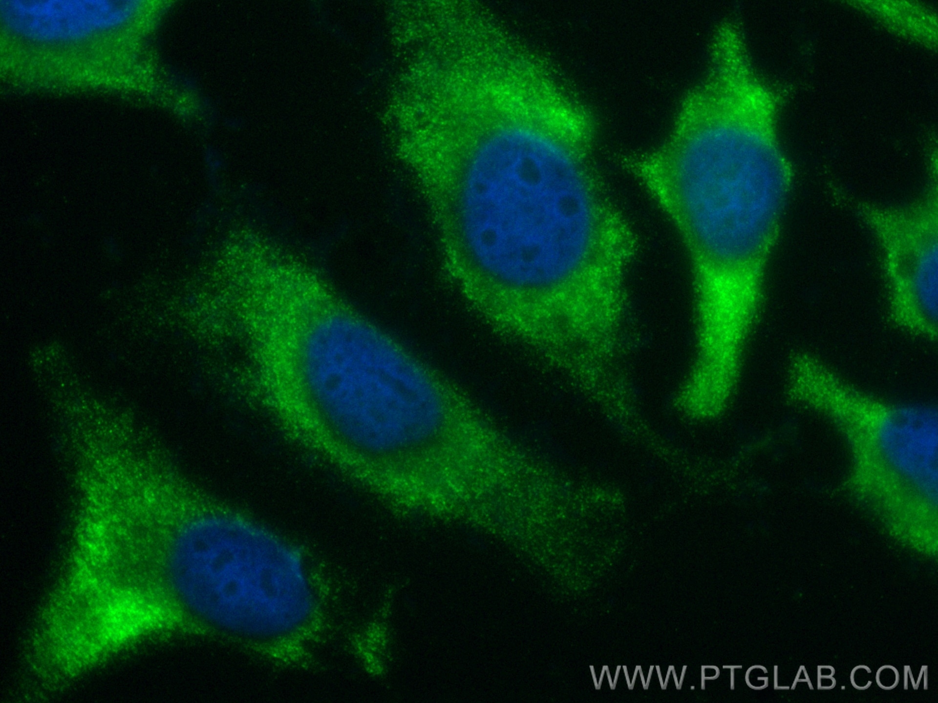 Immunofluorescence (IF) / fluorescent staining of HeLa cells using CoraLite® Plus 488-conjugated EIF5 Polyclonal anti (CL488-11155)