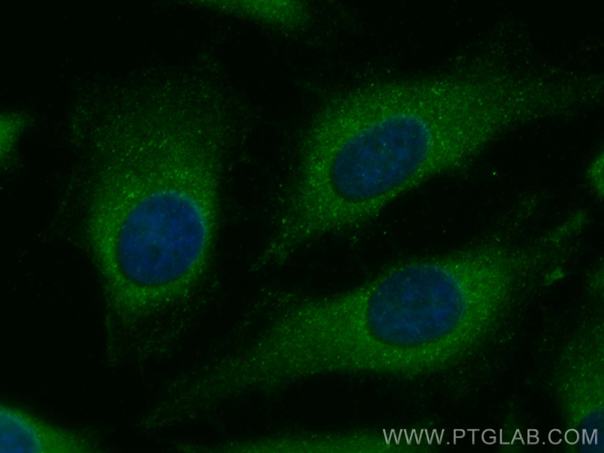 Immunofluorescence (IF) / fluorescent staining of HeLa cells using EIF5A Polyclonal antibody (11309-1-AP)