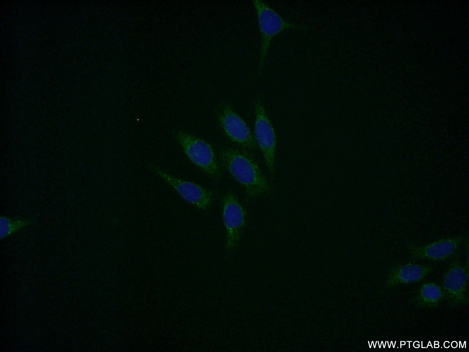 Immunofluorescence (IF) / fluorescent staining of HeLa cells using EIF5A Polyclonal antibody (11309-1-AP)