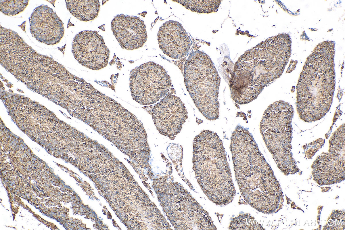 Immunohistochemistry (IHC) staining of mouse testis tissue using EIF5A Polyclonal antibody (11309-1-AP)