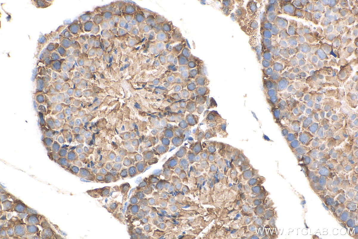 Immunohistochemistry (IHC) staining of mouse testis tissue using EIF5A Polyclonal antibody (11309-1-AP)