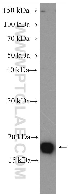 Western Blot (WB) analysis of HeLa cells using EIF5A Polyclonal antibody (11309-1-AP)