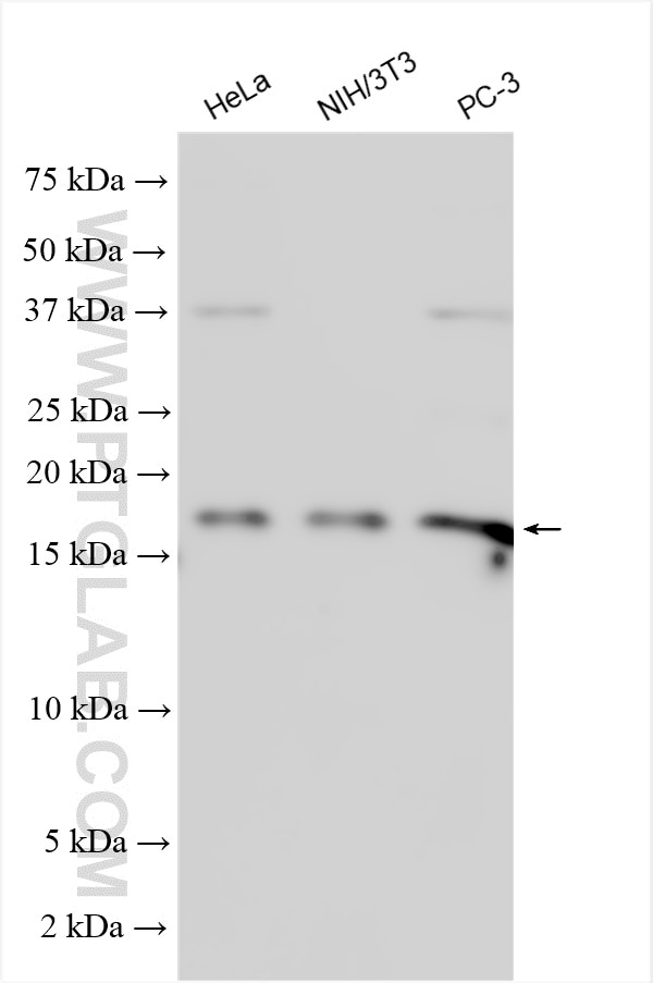 Western Blot (WB) analysis of various lysates using EIF5A Polyclonal antibody (11309-1-AP)