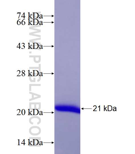 EIF5A fusion protein Ag28588 SDS-PAGE