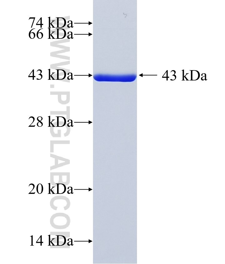 EIF5A fusion protein Ag1849 SDS-PAGE