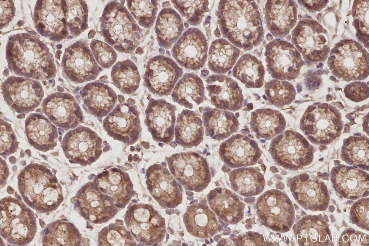 Immunohistochemistry (IHC) staining of mouse colon tissue using EIF5A1/EIF5A2 Polyclonal antibody (17069-1-AP)