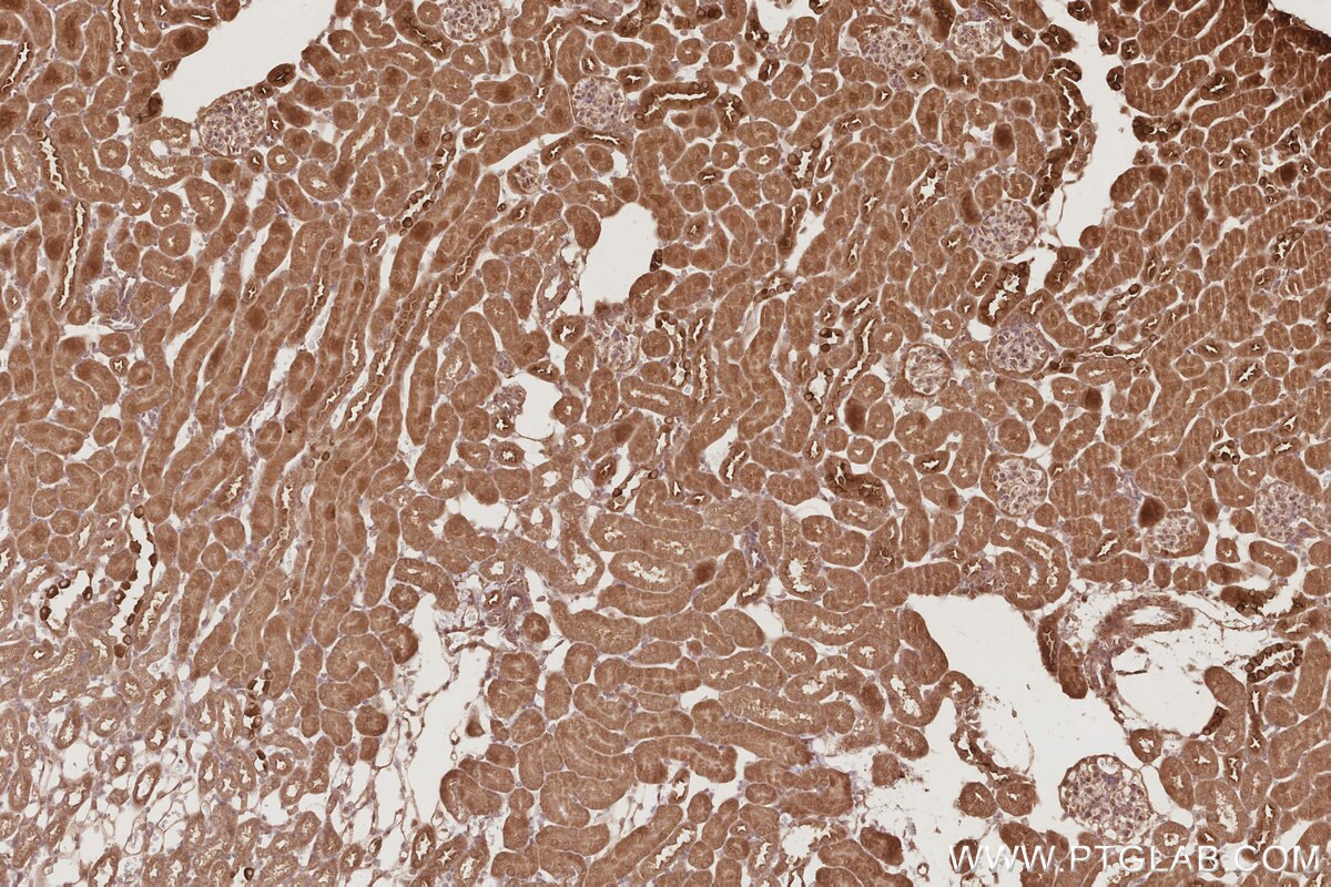 Immunohistochemistry (IHC) staining of mouse kidney tissue using EIF5A1/EIF5A2 Polyclonal antibody (17069-1-AP)