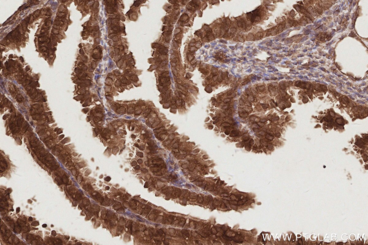 Immunohistochemistry (IHC) staining of mouse ovary tissue using EIF5A1/EIF5A2 Polyclonal antibody (17069-1-AP)