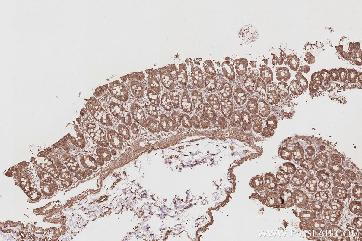 IHC staining of rat colon using 17069-1-AP Immunohistochemistry (IHC) staining of rat colon tissue using EIF5A1/EIF5A2 Polyclonal antibody (17069-1-AP)