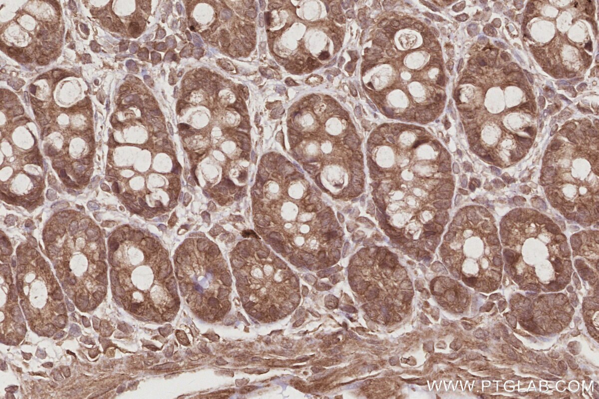 Immunohistochemistry (IHC) staining of rat colon tissue using EIF5A1/EIF5A2 Polyclonal antibody (17069-1-AP)