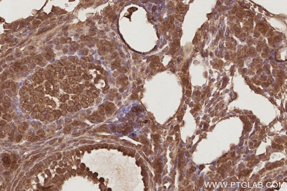 Immunohistochemistry (IHC) staining of mouse ovary tissue using EIF5A1/EIF5A2 Polyclonal antibody (17069-1-AP)