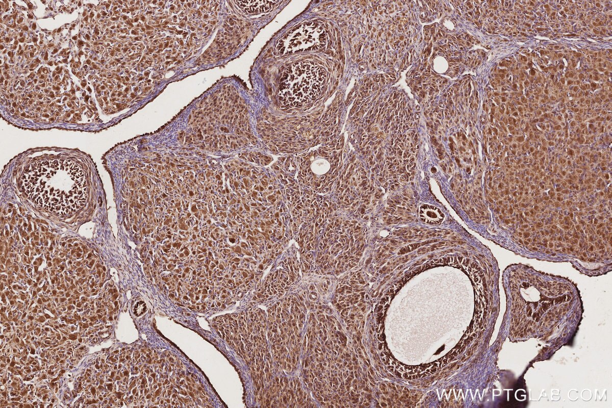Immunohistochemistry (IHC) staining of rat ovary tissue using EIF5A1/EIF5A2 Polyclonal antibody (17069-1-AP)