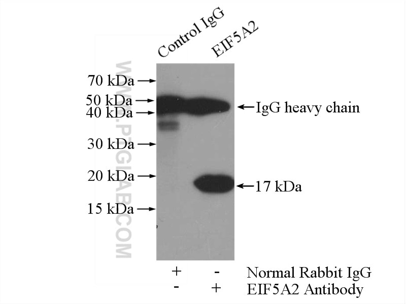 Immunoprecipitation (IP) experiment of mouse brain tissue using EIF5A1/EIF5A2 Polyclonal antibody (17069-1-AP)