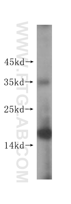 Western Blot (WB) analysis of A2780 cells using EIF5A1/EIF5A2 Polyclonal antibody (17069-1-AP)