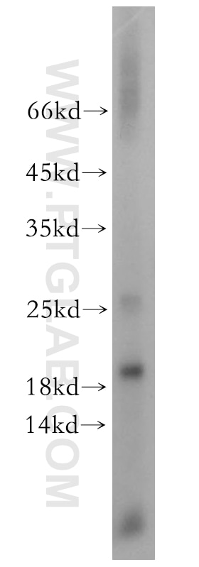 Western Blot (WB) analysis of mouse testis tissue using EIF5A1/EIF5A2 Polyclonal antibody (17069-1-AP)