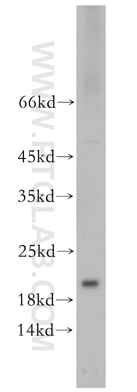 Western Blot (WB) analysis of mouse brain tissue using EIF5A1/EIF5A2 Polyclonal antibody (17069-1-AP)