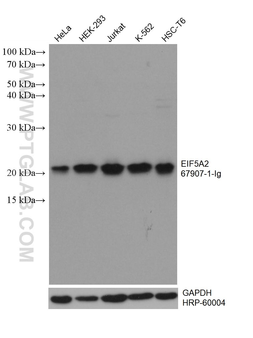 Western Blot (WB) analysis of various lysates using EIF5A2 Monoclonal antibody (67907-1-Ig)