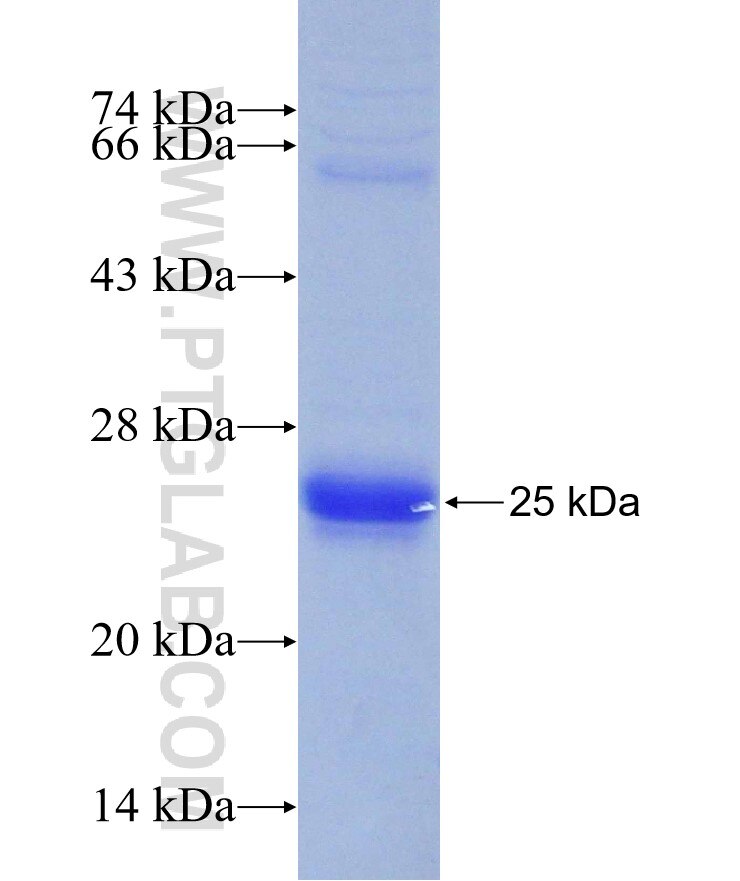 EIF5A2 fusion protein Ag10852 SDS-PAGE