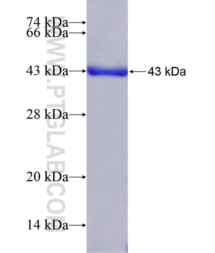 EIF5A2 fusion protein Ag10895 SDS-PAGE