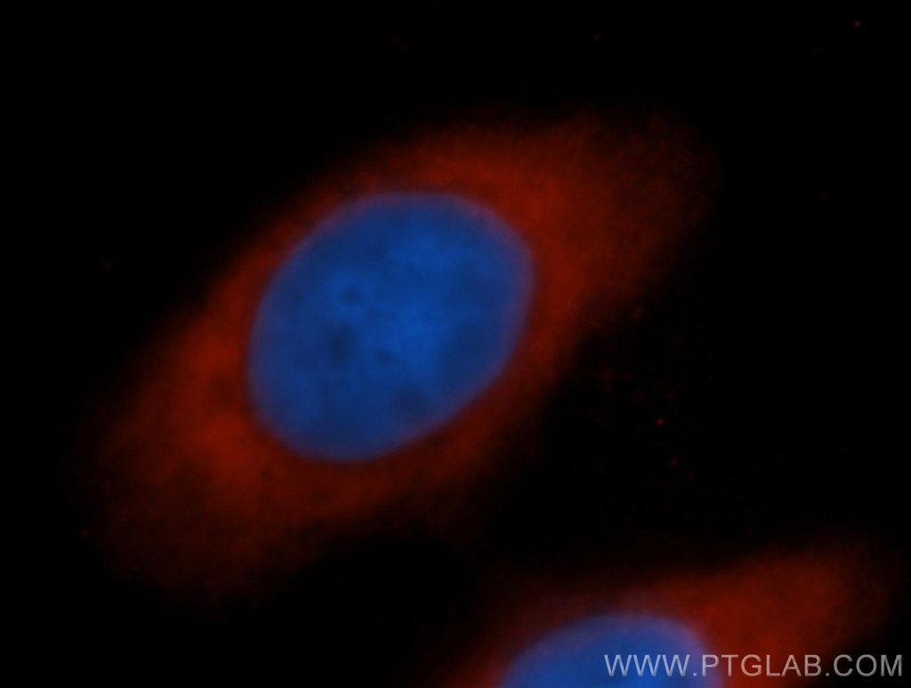 Immunofluorescence (IF) / fluorescent staining of MCF-7 cells using EIF5B Polyclonal antibody (13527-1-AP)