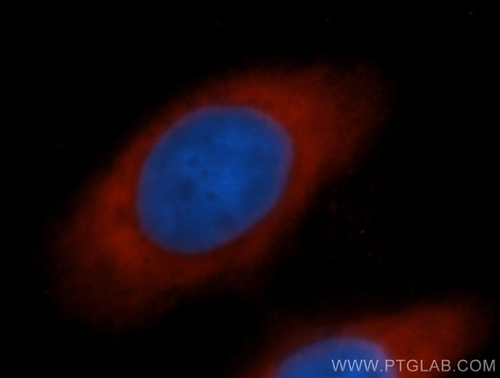 IF Staining of MCF-7 using 13527-1-AP