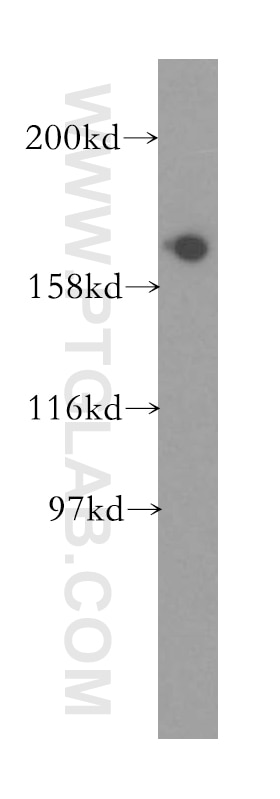 Western Blot (WB) analysis of mouse brain tissue using EIF5B Polyclonal antibody (13527-1-AP)