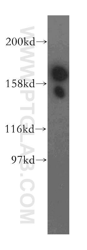 Western Blot (WB) analysis of A549 cells using EIF5B Polyclonal antibody (13527-1-AP)