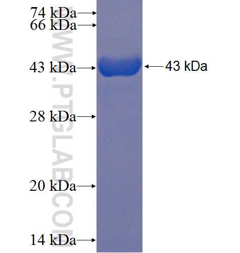 EIF5B fusion protein Ag5165 SDS-PAGE