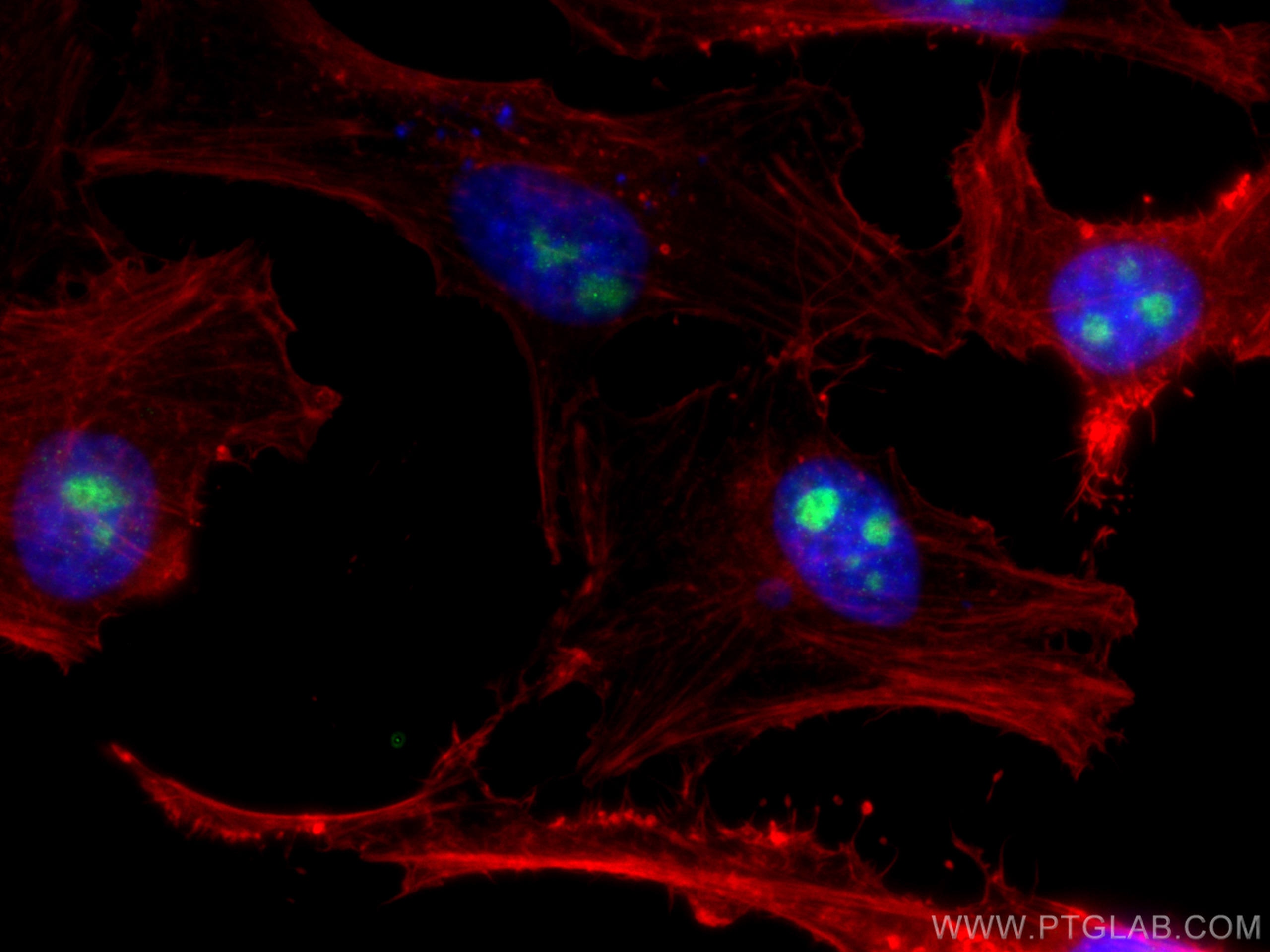 Immunofluorescence (IF) / fluorescent staining of HeLa cells using EIF6 Polyclonal antibody (10291-1-AP)