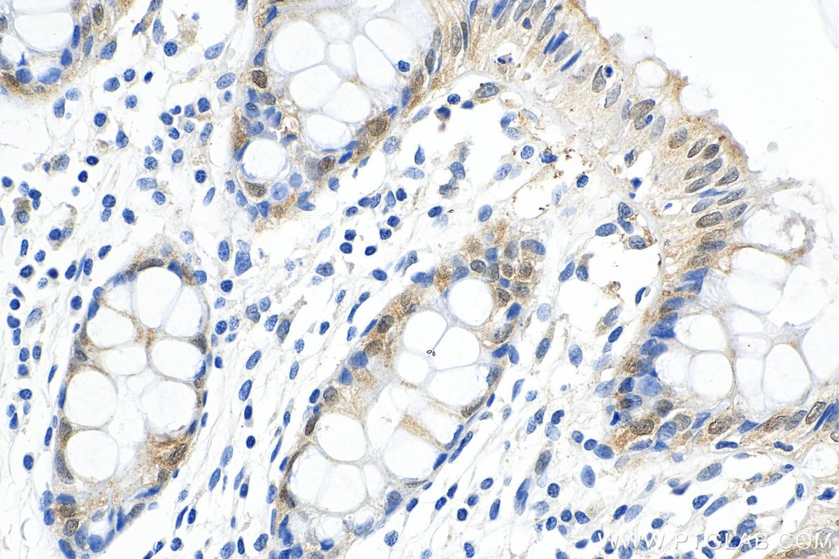 Immunohistochemistry (IHC) staining of human colon tissue using EIF6 Polyclonal antibody (10291-1-AP)