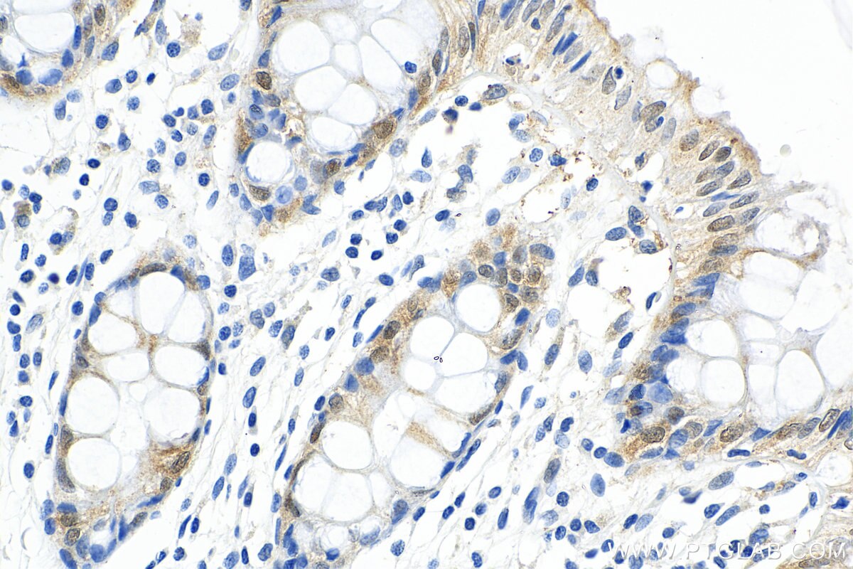 IHC staining of human colon using 10291-1-AP