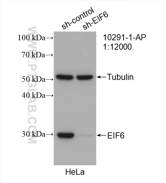 WB analysis of HeLa using 10291-1-AP