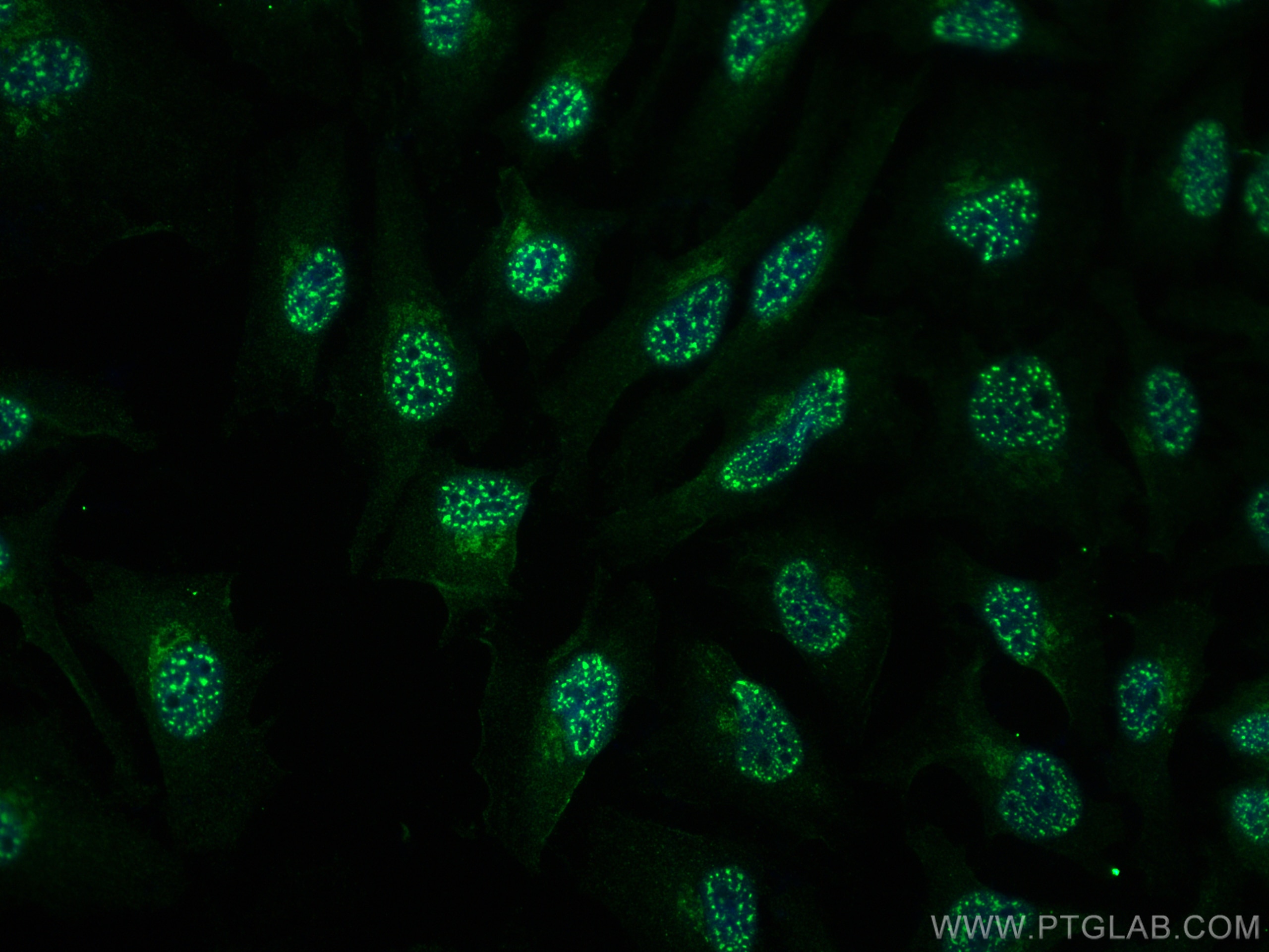 Immunofluorescence (IF) / fluorescent staining of HeLa cells using EIF6 Monoclonal antibody (68765-3-Ig)