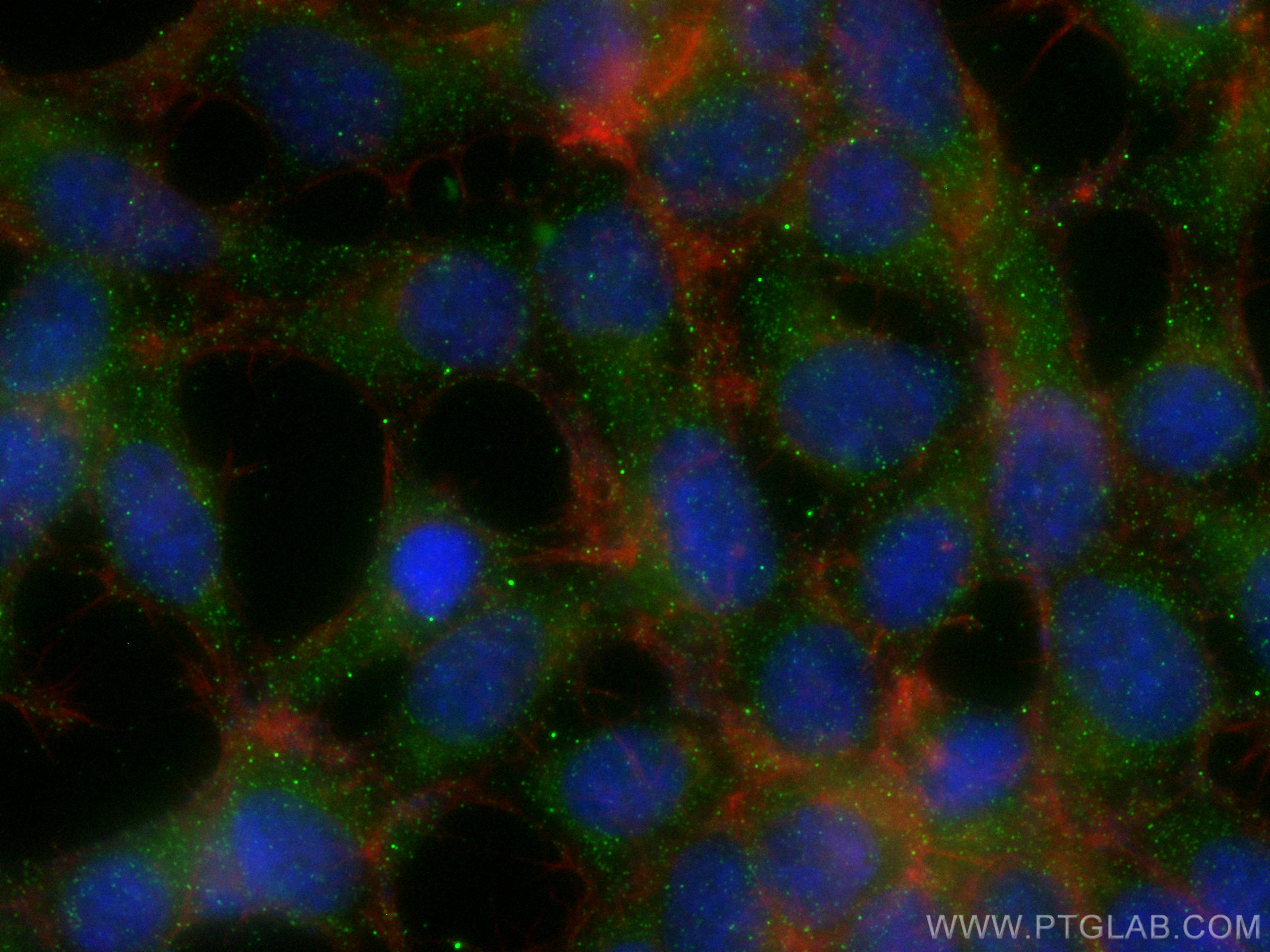 Immunofluorescence (IF) / fluorescent staining of HEK-293 cells using ELA2 Polyclonal antibody (27642-1-AP)