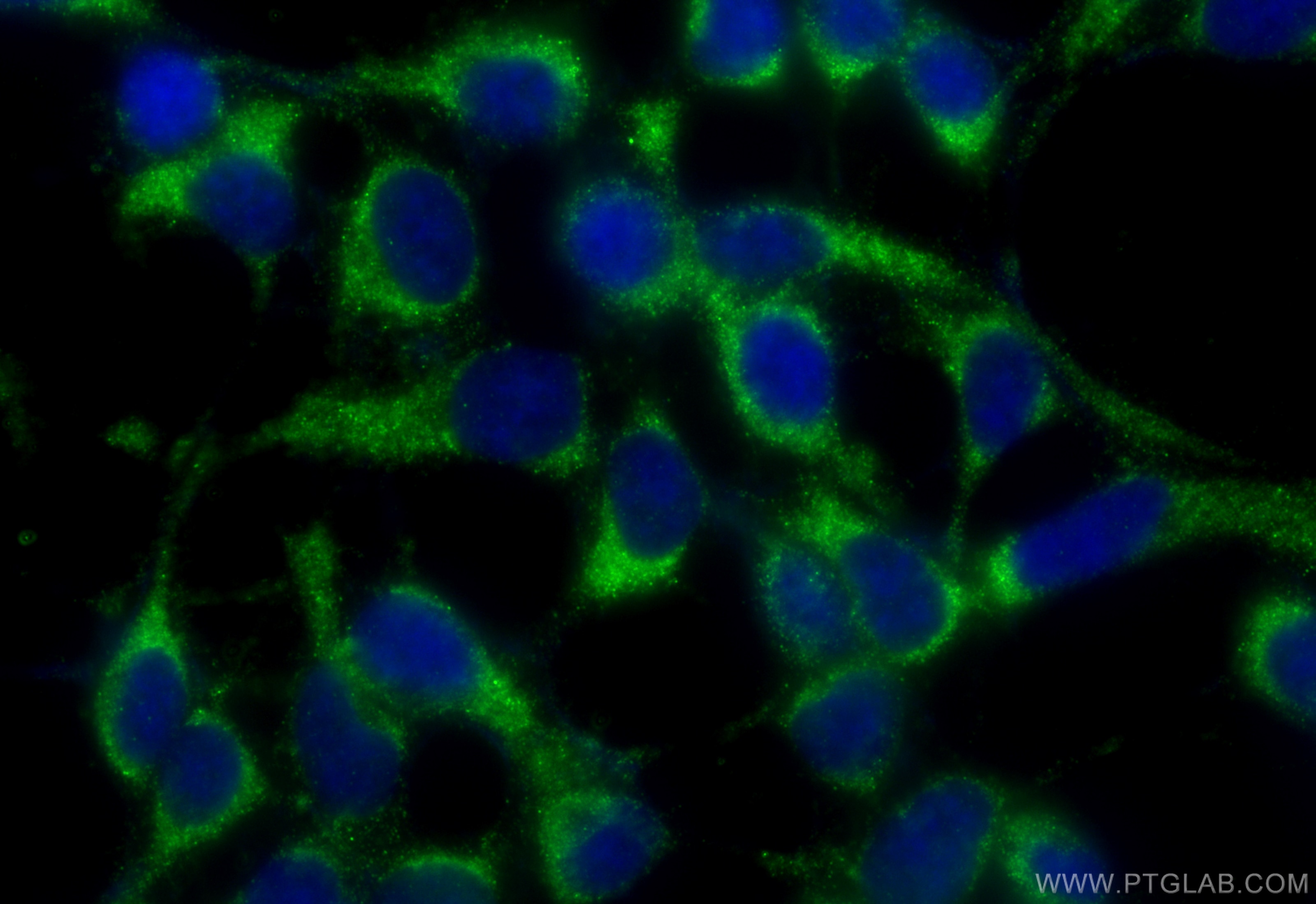 Immunofluorescence (IF) / fluorescent staining of HEK-293 cells using Neutrophil Elastase Polyclonal antibody (27642-1-AP)