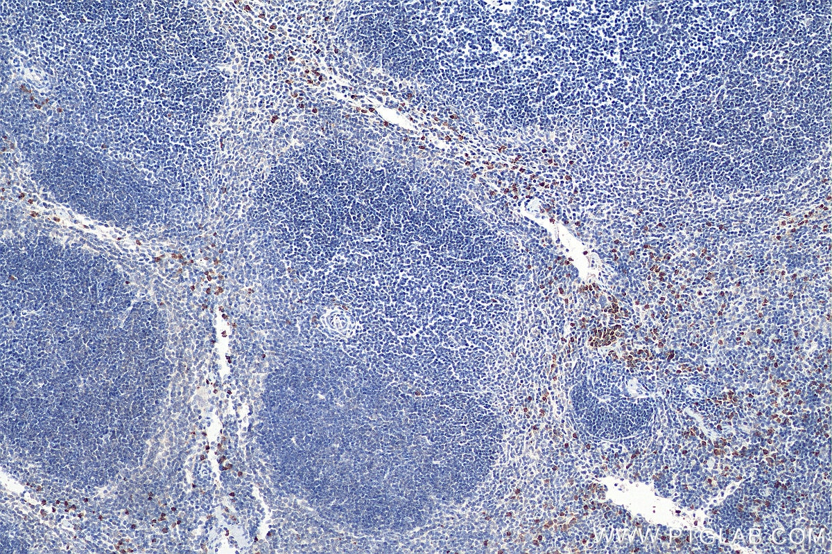Immunohistochemistry (IHC) staining of mouse spleen tissue using ELA2 Polyclonal antibody (27642-1-AP)