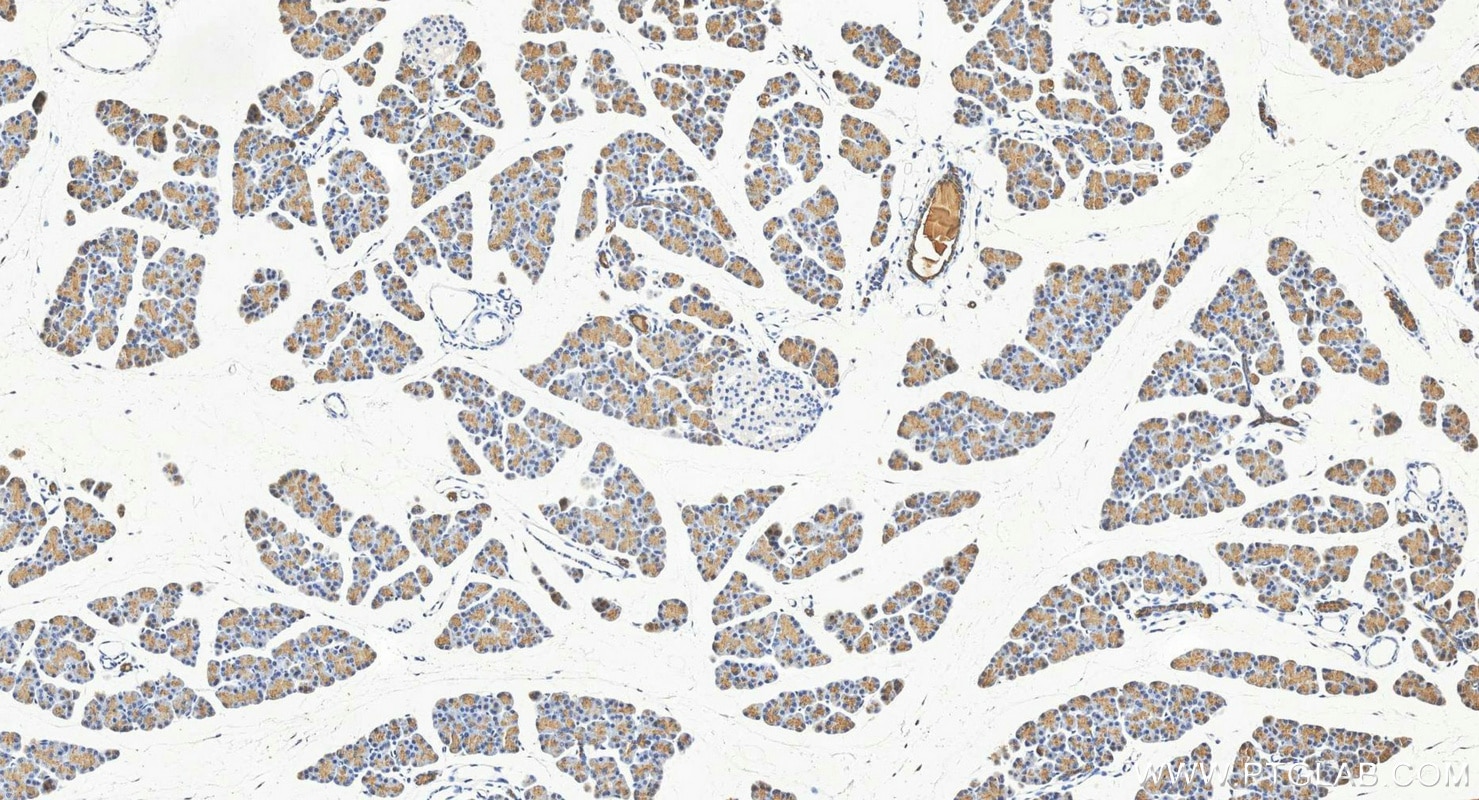 Immunohistochemistry (IHC) staining of rat pancreas tissue using ELA3A Polyclonal antibody (15737-1-AP)