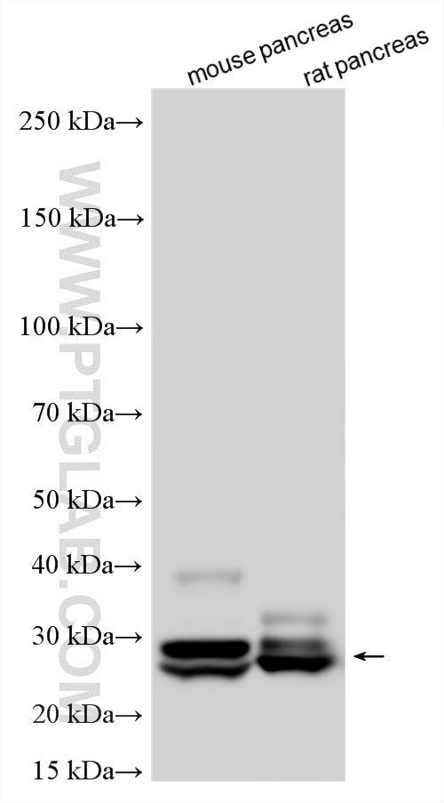 WB analysis using 15737-1-AP Western Blot (WB) analysis of various lysates using ELA3A Polyclonal antibody (15737-1-AP)