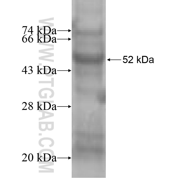 ELA3A fusion protein Ag8536 SDS-PAGE
