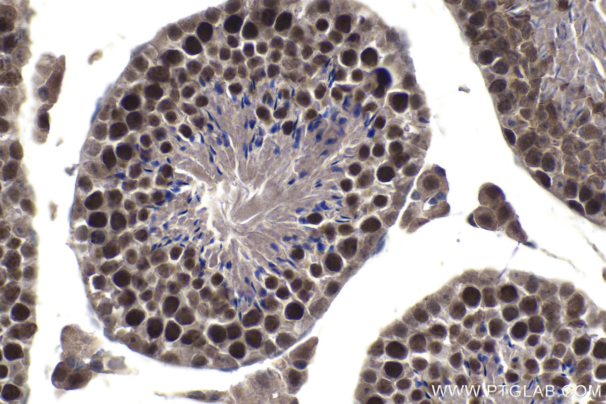 Immunohistochemistry (IHC) staining of mouse testis tissue using ELAC2 Polyclonal antibody (10071-1-AP)