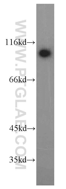 Western Blot (WB) analysis of HeLa cells using ELAC2 Polyclonal antibody (10071-1-AP)