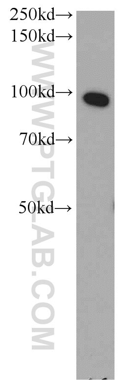 Western Blot (WB) analysis of HepG2 cells using ELAC2 Polyclonal antibody (10071-1-AP)