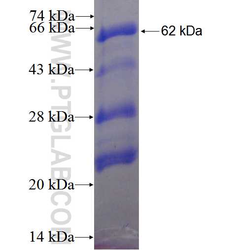 ELAC2 fusion protein Ag0105 SDS-PAGE