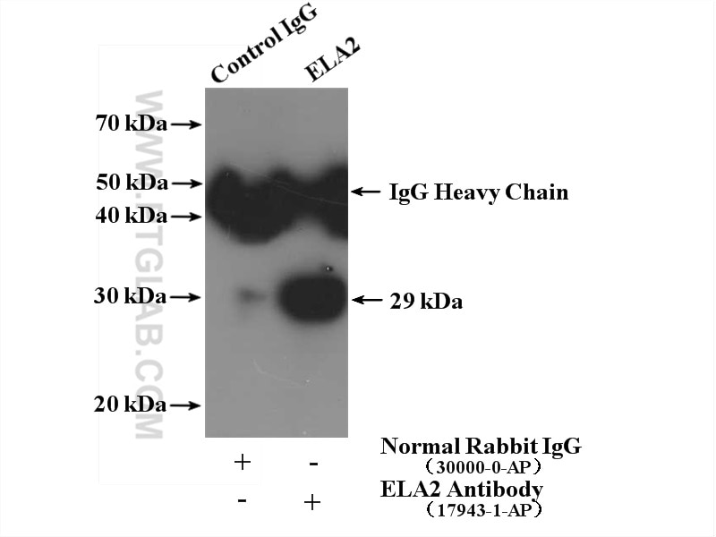 ELA2 Polyclonal antibody